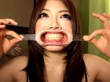 口腔羞恥！！ 素人歯科淫診02 派遣社員の優美ちゃん編